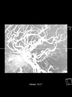 DICOM